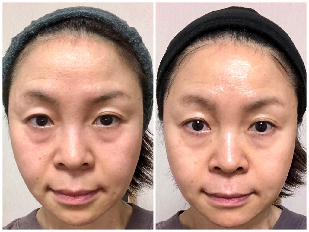 18プリマトリーチェ | remore株式会社 プリマトリーチェ 07 オイルエッセンス